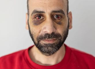 Мигранты рассказали Reuters, как их били беларусские силовики и не пускали обратно