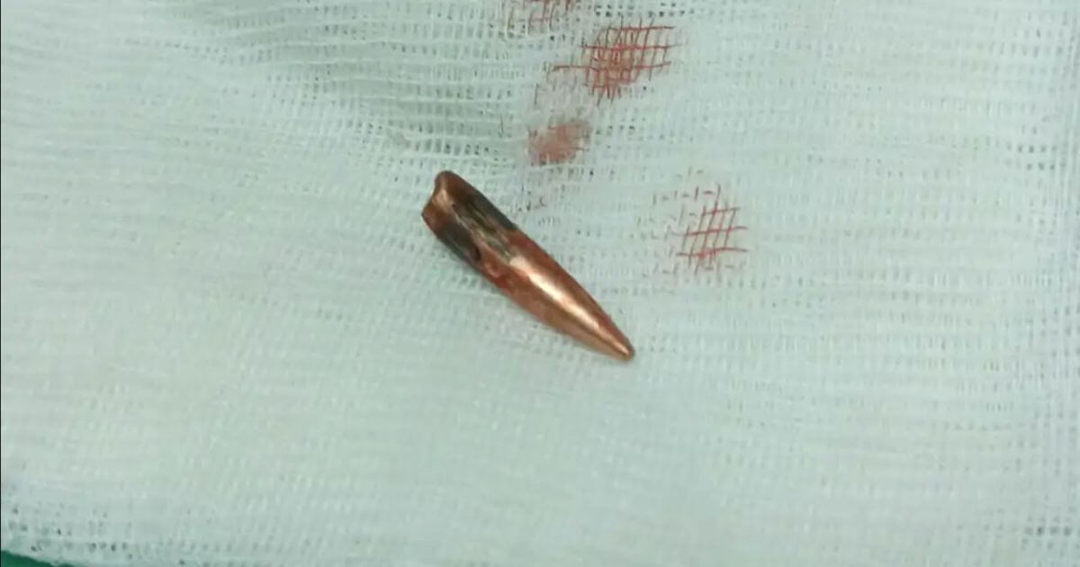 «У некаторых не было вачэй, у кагосьці часткі мозгу»: лекар з Мазыра, які лячыў салдат ВС РФ, распавёў і паказаў, што адбывалася ў беларускіх шпіталях у пачатку вайны